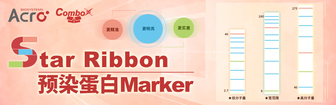 Star Ribbon 预染蛋白 Marker